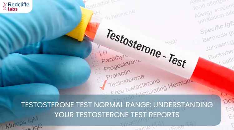 Testosterone Test Normal Range: Understanding Your Testosterone Test Reports
