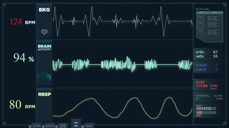 2D Echo Test: Price, Types, Procedure, Complications, & More
