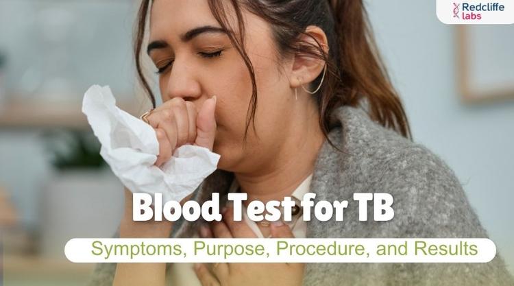 Blood Test for TB: Symptoms, Purpose, Procedure, and Results