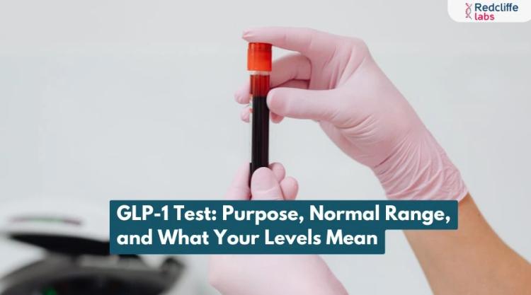 GLP-1 Test: Purpose, Normal Range, and What Your Levels Mean