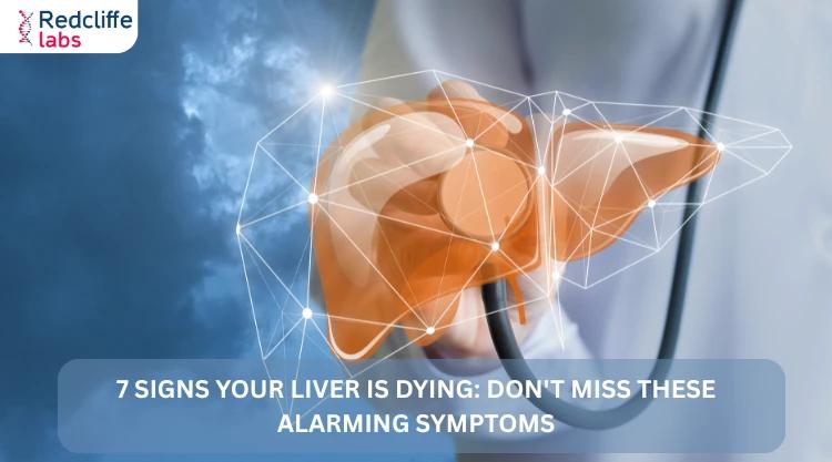 7 Signs Your Liver Is Dying: Don't Miss These Alarming Symptoms