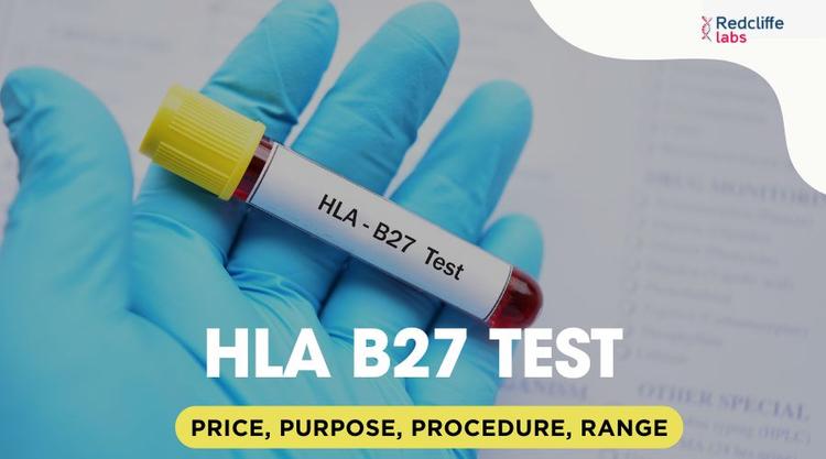 HLA B27 Test: Price, Purpose, Procedure, Range, & More