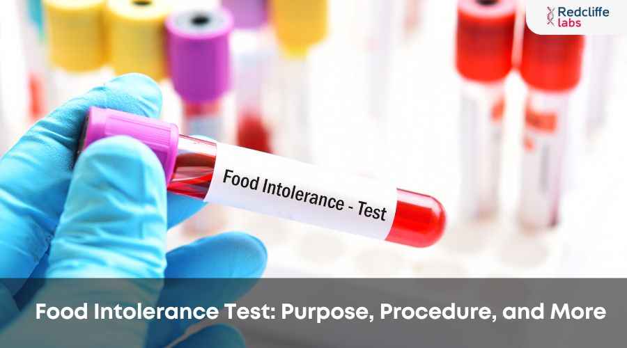 Food Intolerance Test: Purpose, Procedure, and More