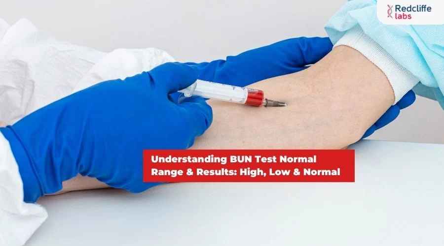 Understanding BUN Test Normal Range & Results: High, Low & Normal