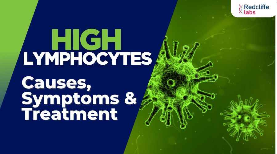 High Lymphocytes Causes, Symptoms & Treatment