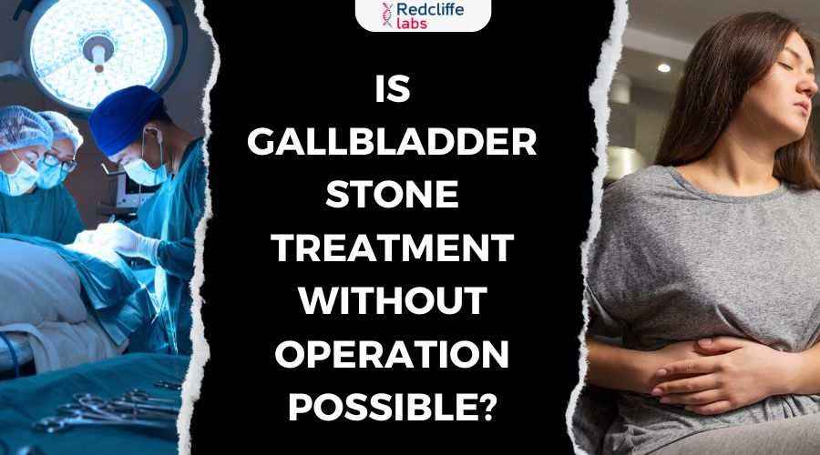 Is Gallbladder Stone Treatment Without Operation Possible?