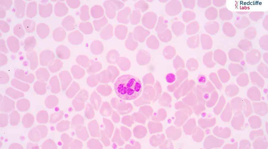 Platelets Meaning in Marathi: काय आहेत आणि त्यांचे कार्य काय आहे?