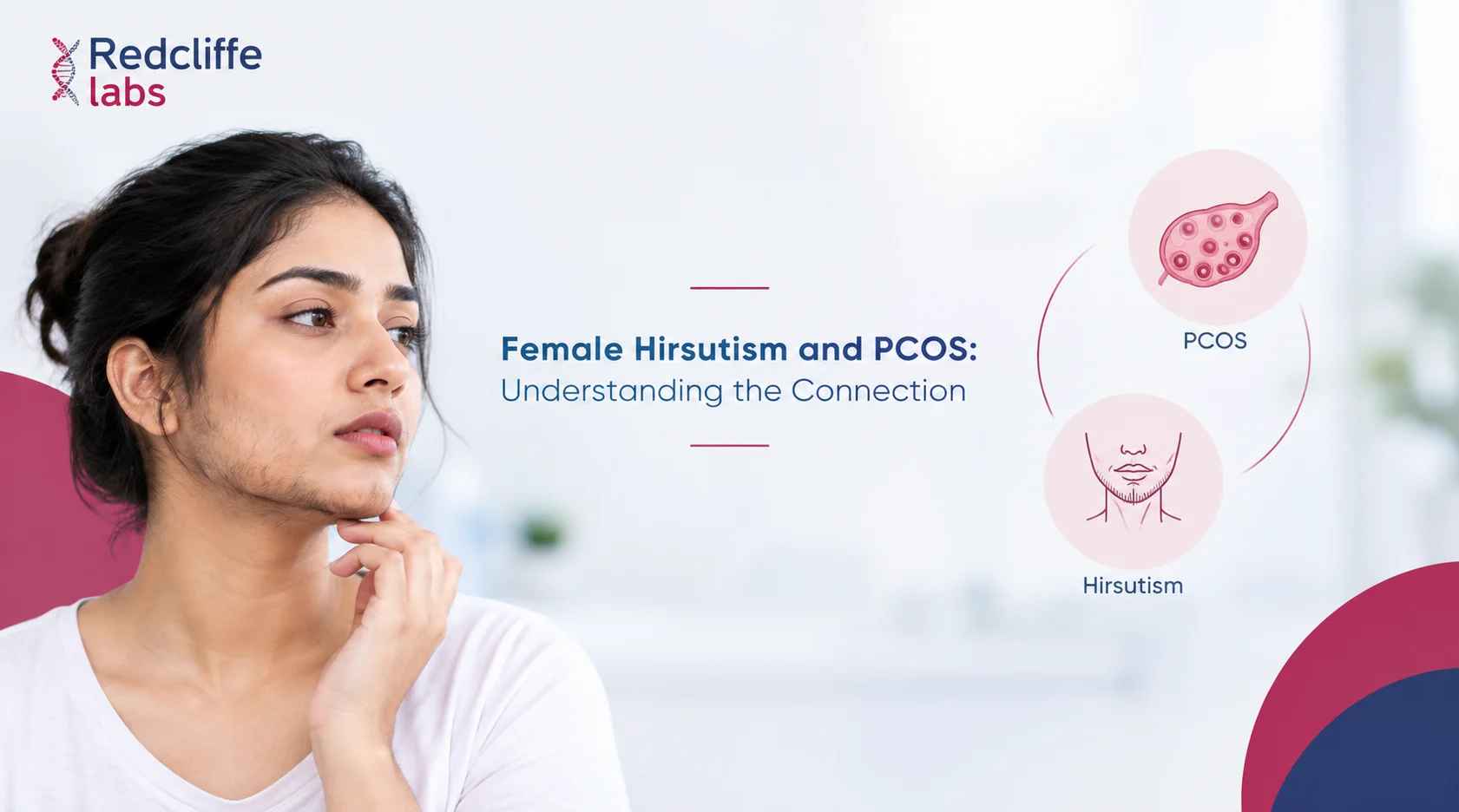 Female Hirsutism and PCOS: Understanding the Connection
