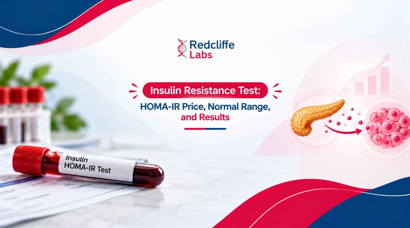 Insulin Resistance Test: HOMA-IR Normal Range & Results