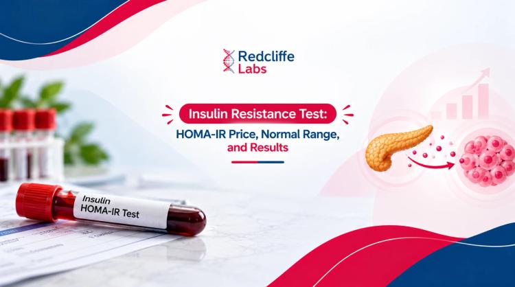 Insulin Resistance Test: HOMA-IR Normal Range & Results