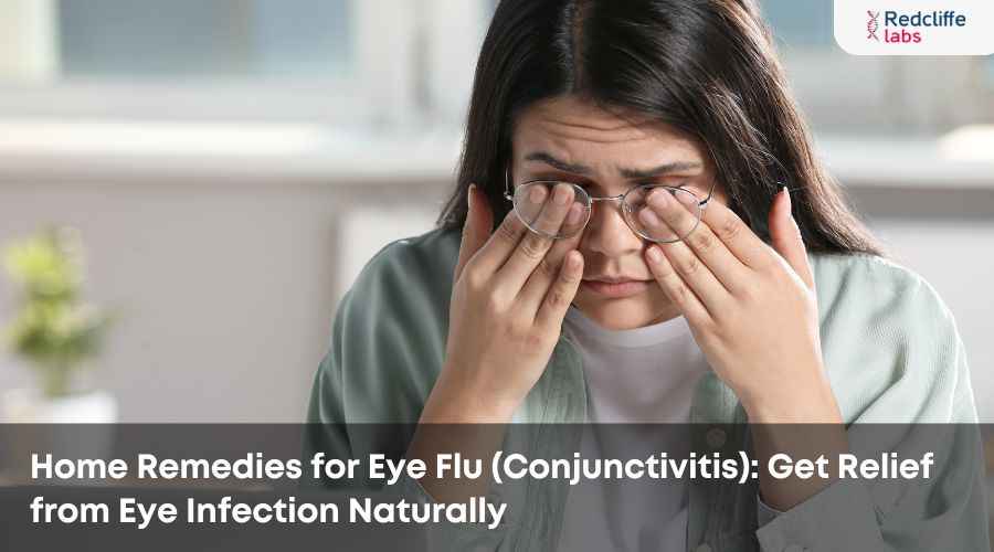 Home Remedies for Eye Flu (Conjunctivitis): Get Relief from Eye Infection Naturally