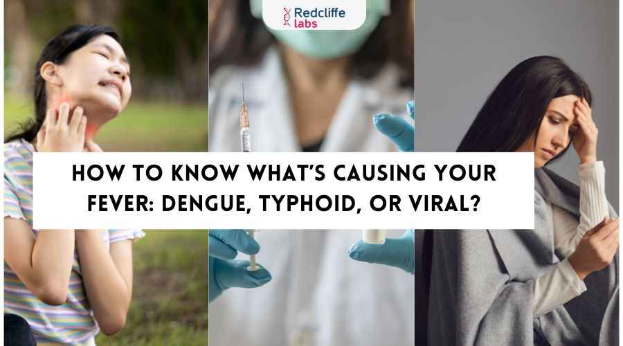 How to Know What’s Causing Your Fever: Dengue, Typhoid, or Viral?