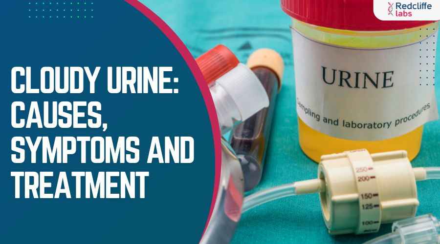 Cloudy Urine: Causes, Symptoms and treatment