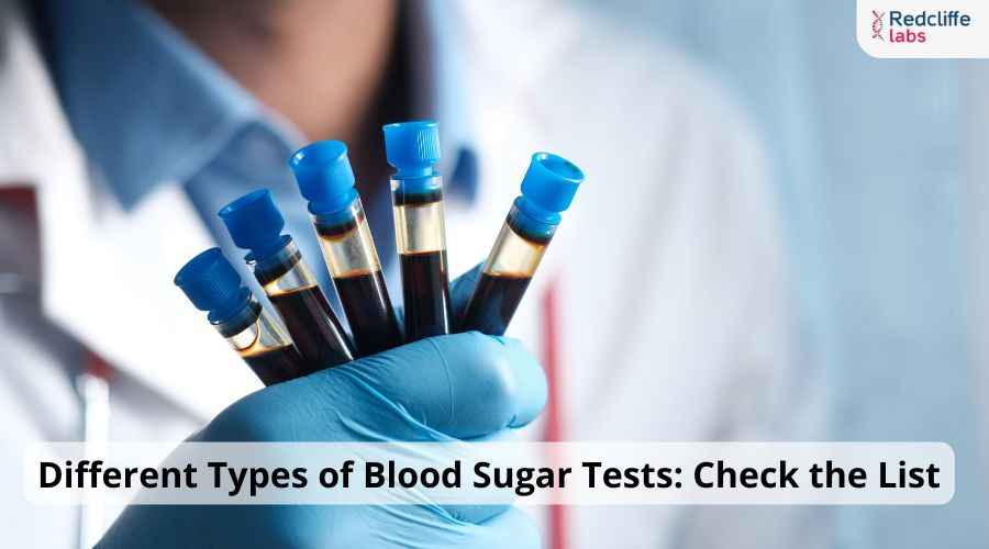 Different Types of Blood Sugar Tests: Check the List