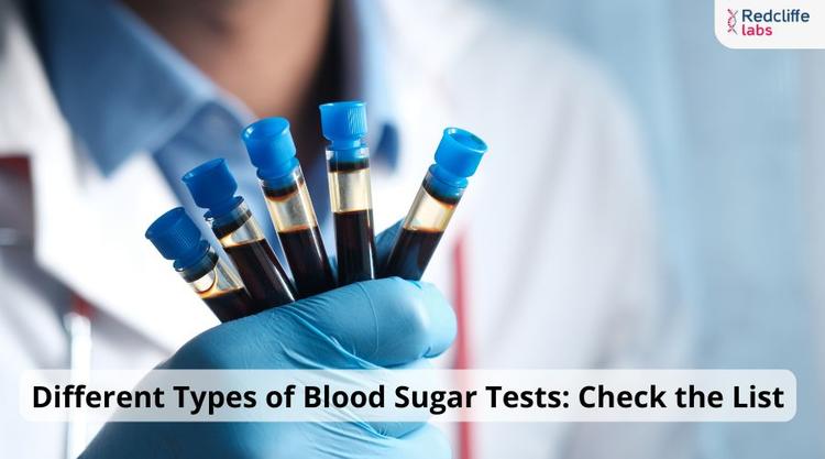 Different Types of Blood Sugar Tests: Check the List