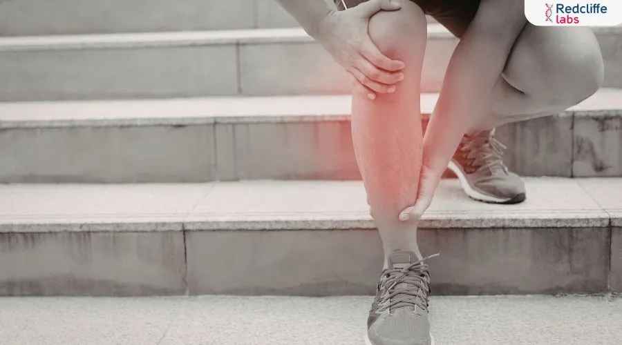 5 Lifestyle Changes That Can Help Reduce Swelling in the Legs