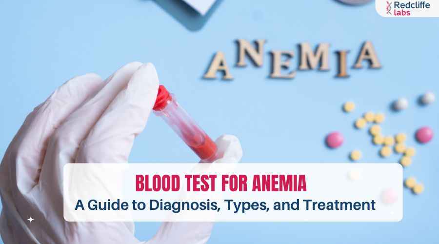 Blood Test for Anemia: A Guide to Diagnosis, Types, and Treatment