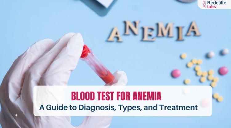 Blood Test for Anemia: A Guide to Diagnosis, Types, and Treatment
