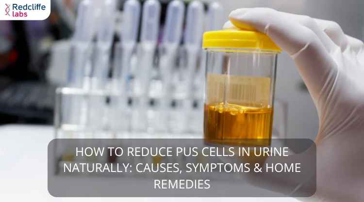 How to Reduce Pus Cells in Urine Naturally: Causes, Symptoms & Home Remedies
