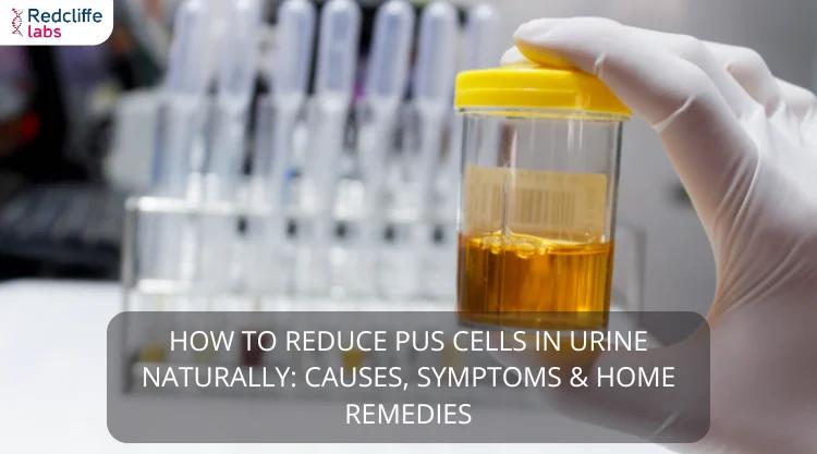 How to Reduce Pus Cells in Urine Naturally: Causes, Symptoms & Home Remedies