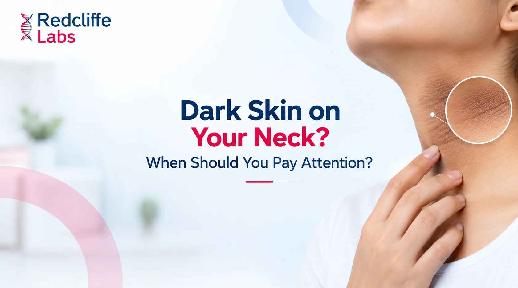 Dark Skin on Your Neck? When Should You Pay Attention?