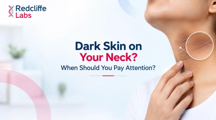 Dark Skin on Your Neck? When Should You Pay Attention?