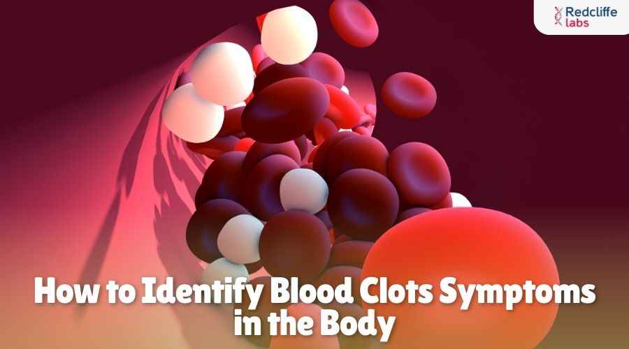 How to Identify Blood Clots Symptoms in the Body?