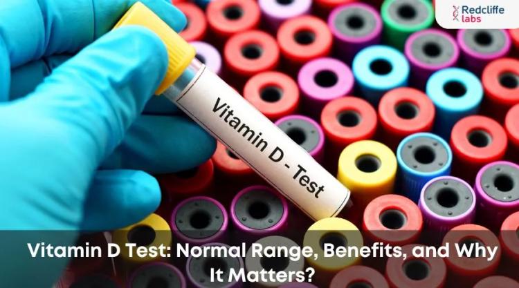 Vitamin D Test: Normal Range, Benefits, and Why It Matters?