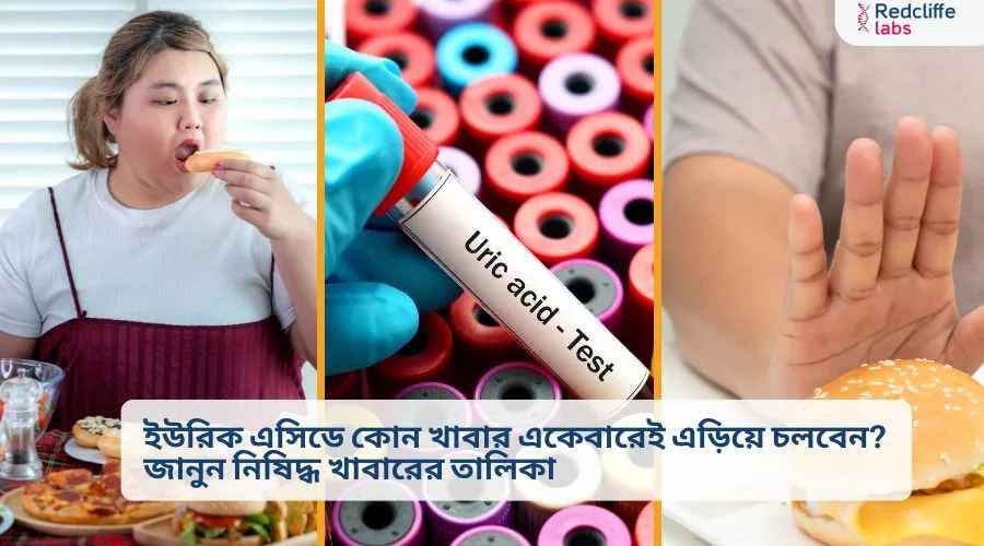 ইউরিক এসিডে কোন খাবার একেবারেই এড়িয়ে চলবেন? জানুন নিষিদ্ধ খাবারের তালিকা