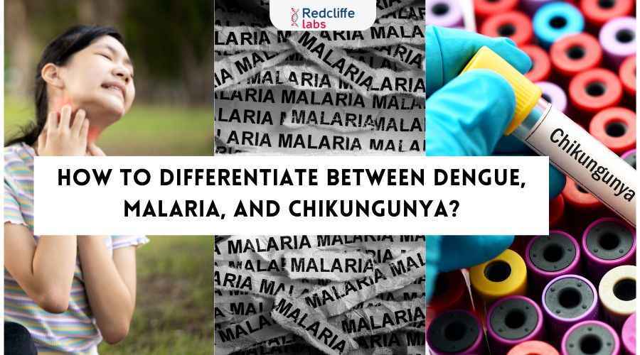 How to Differentiate Between Dengue, Malaria, and Chikungunya?