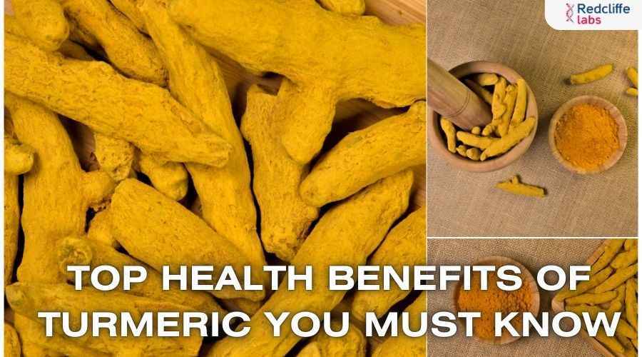 Top Health Benefits of Turmeric You Must Know