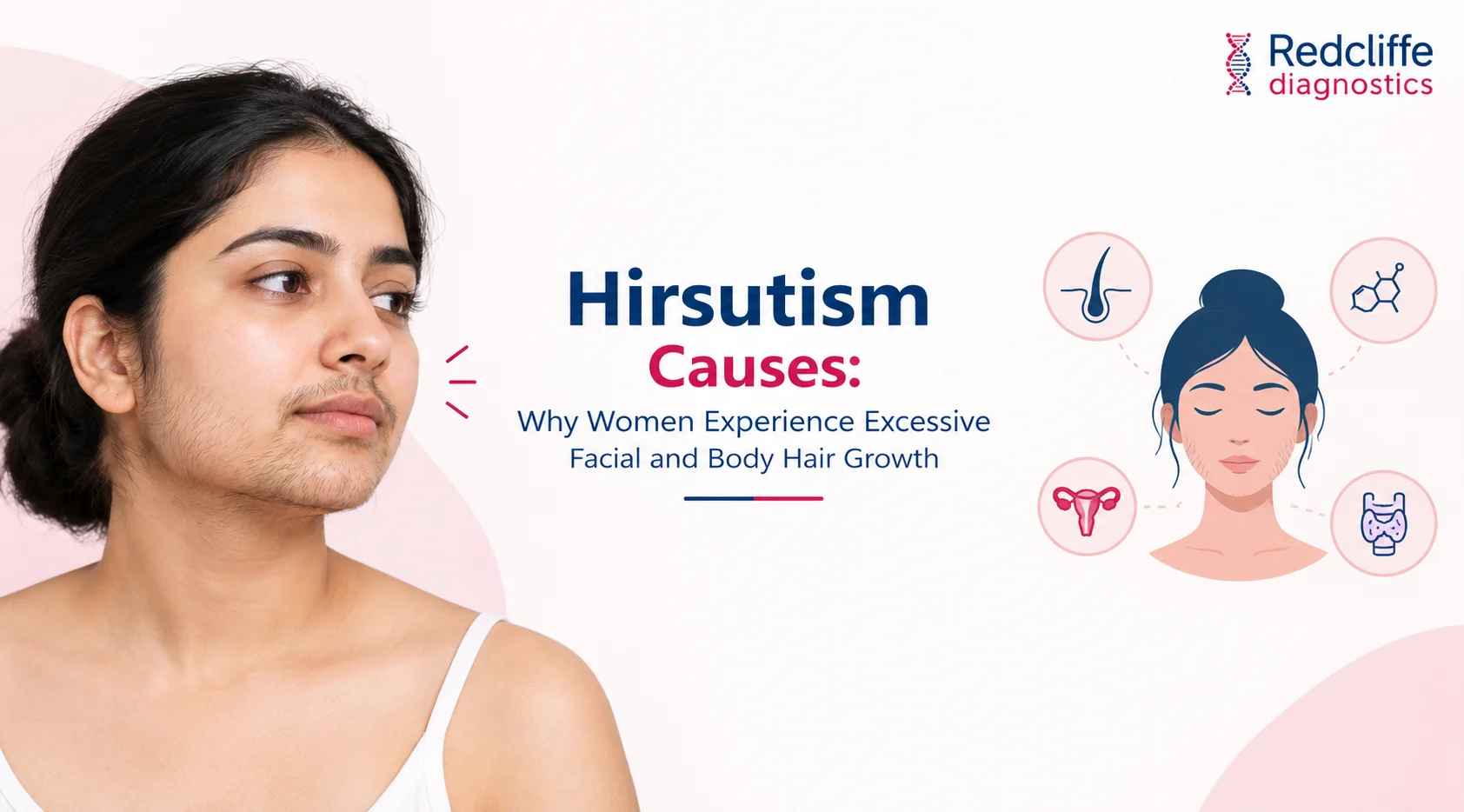 Hirsutism Causes: Why Women Experience Excessive Facial and Body Hair Growth