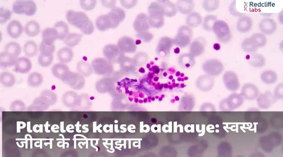 Platelets kaise badhaye: स्वस्थ जीवन के लिए सुझाव