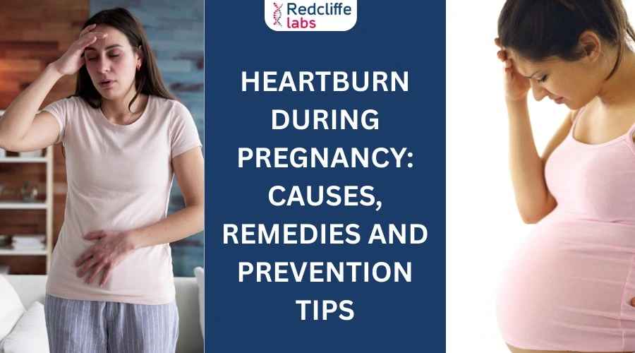 Heartburn During Pregnancy: Causes, Remedies, and Prevention Tips