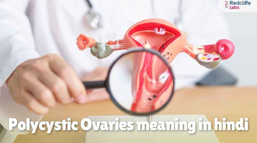Polycystic Ovaries Meaning in Hindi: कारण, लक्षण और उपचार
