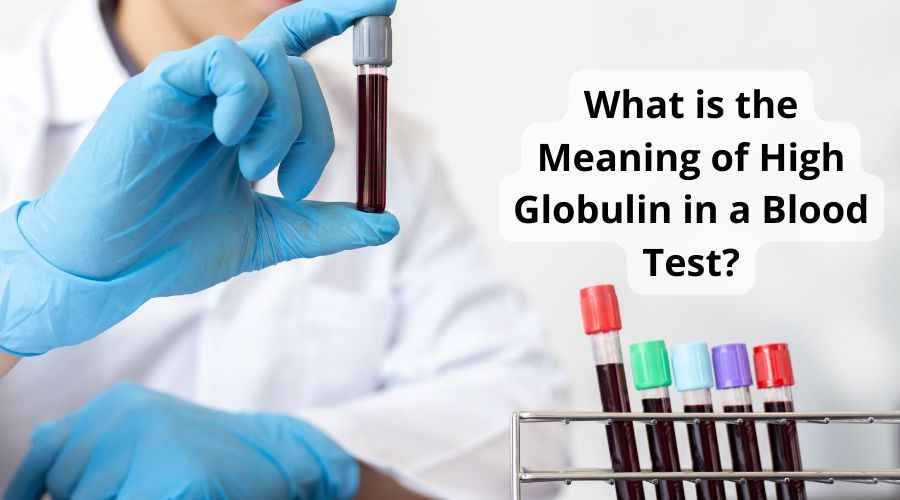 What is the Meaning of High Globulin in a Blood Test?