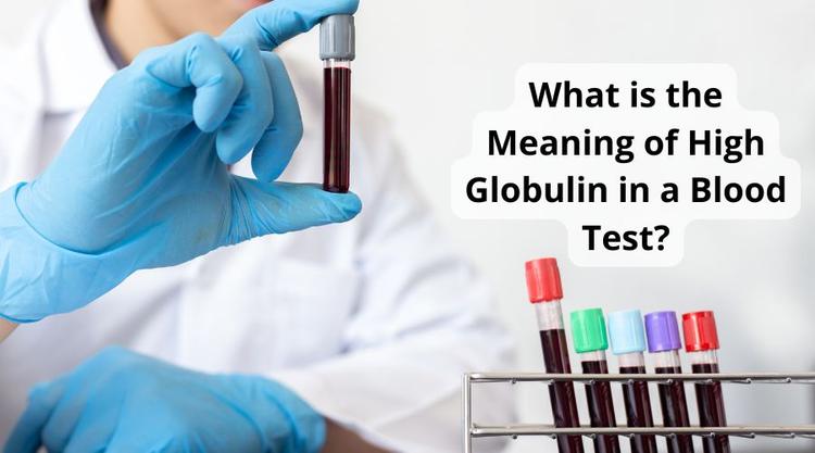 What is the Meaning of High Globulin in a Blood Test?