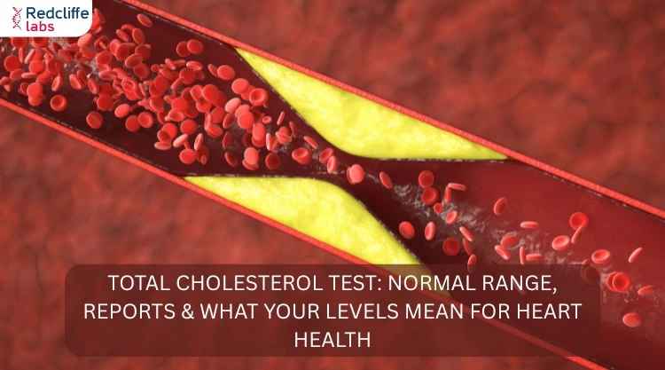 Total Cholesterol Test: Normal Range, Reports & What Your Levels Mean for Heart Health