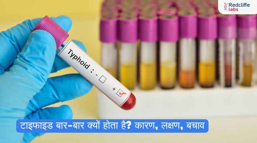 टाइफाइड बार-बार क्यों होता है? कारण, लक्षण, बचाव