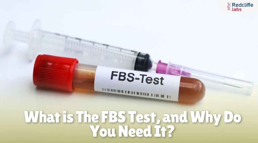 What is The FBS Test, and Why Do You Need It?