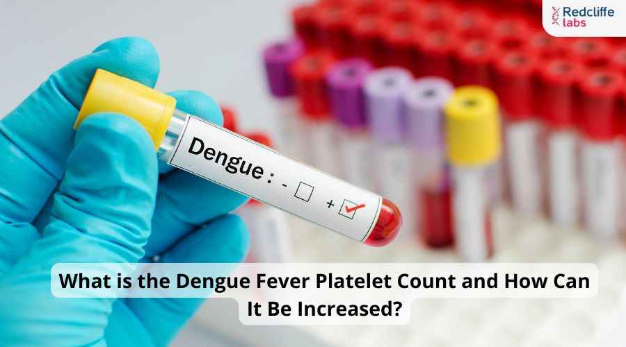What is the Dengue Fever Platelet Count and How Can It Be Increased?