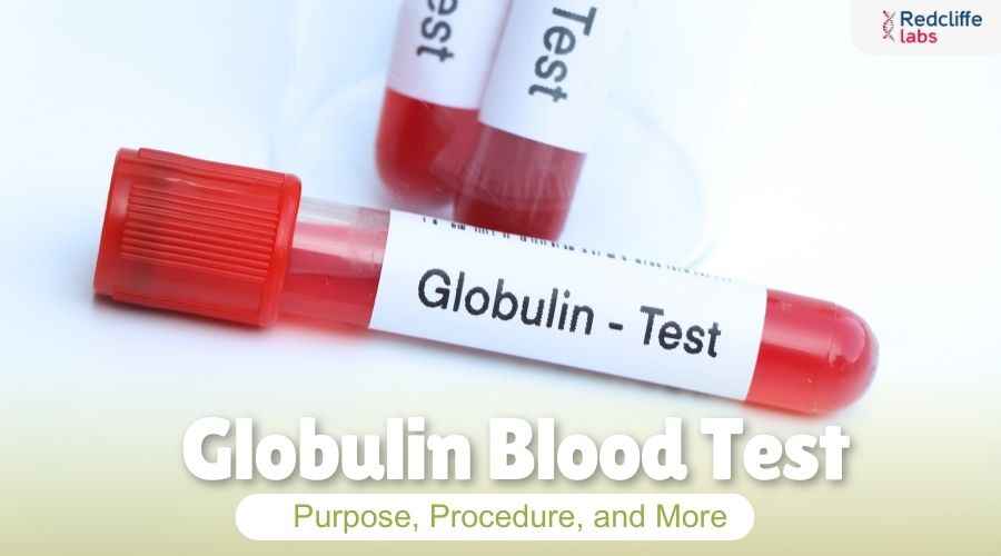 Globulin Blood Test: Purpose, Procedure, and More