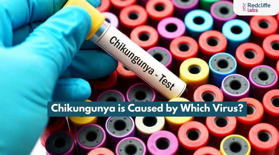 Chikungunya is Caused by Which Virus?