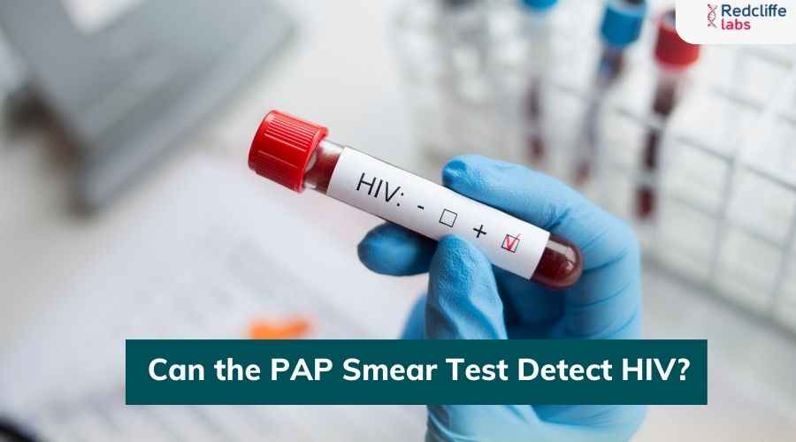 Can the PAP Smear Test Detect HIV?