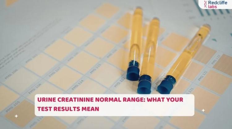 Urine Creatinine Normal Range: What Your Test Results Mean