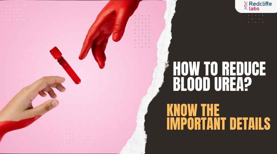 How to Reduce Blood Urea? Know the Important Details