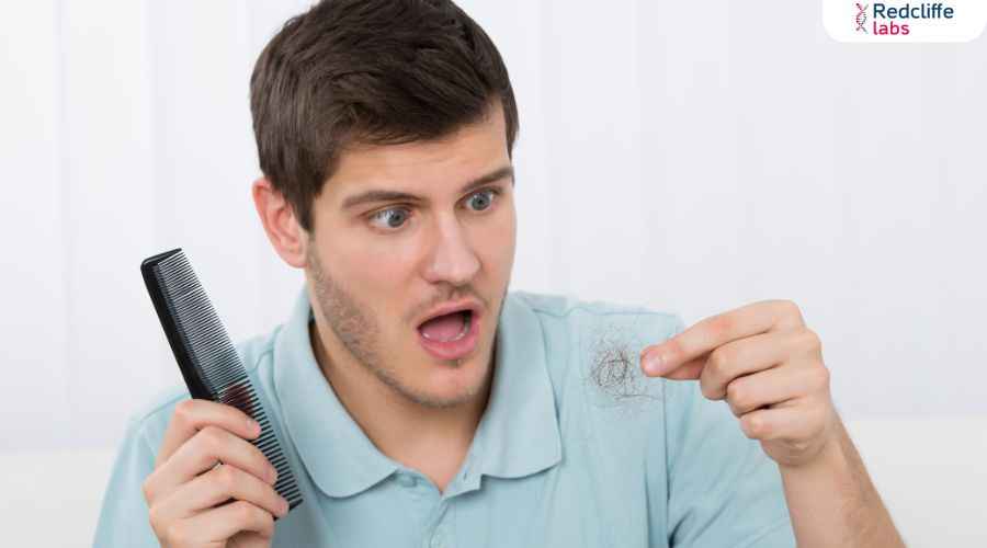 How to Stop Hair Fall? (Baal Jhadna Kaise Roke) जानें प्रभावी उपाय