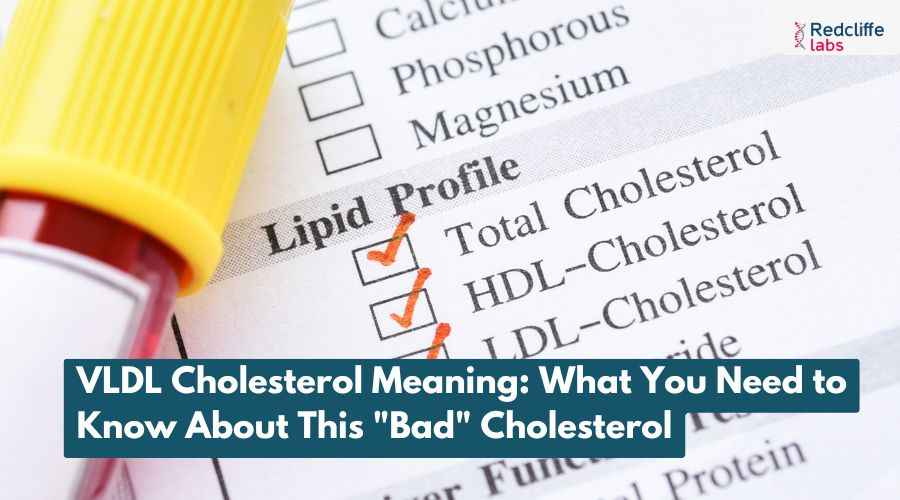 VLDL Cholesterol: Symptoms, Causes, Levels, & Treatment