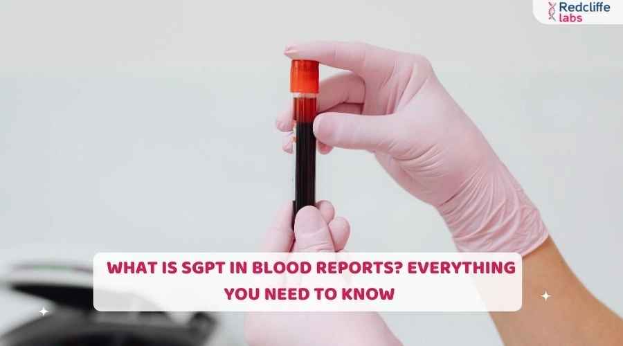 What is SGPT in Blood Reports? Everything You Need to Know