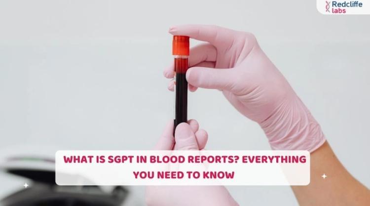 What is SGPT in Blood Reports? Everything You Need to Know